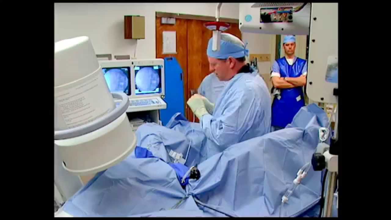 LASER LITHOTRIPSY - YouTube