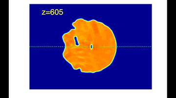 Flyby encounter of a rarefaction pulse with a vortex-antivortex pair in liquid light