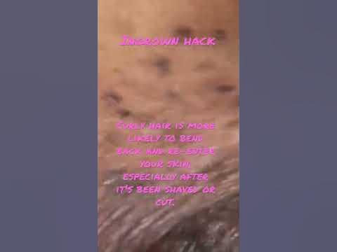Stop Ingrown Hairs On Intimate Areas #shorts skincaretips #