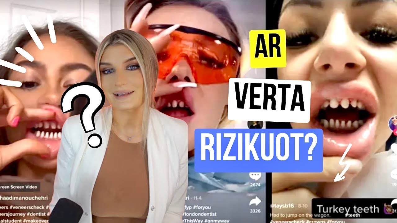 Turkijos šypsena🦷