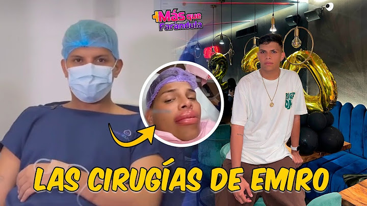 The surgeries that transformed Emiro Navarro.