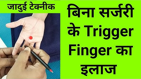 amazing massage technique for trigger finger treatment at home - cure trigger finger without surgery