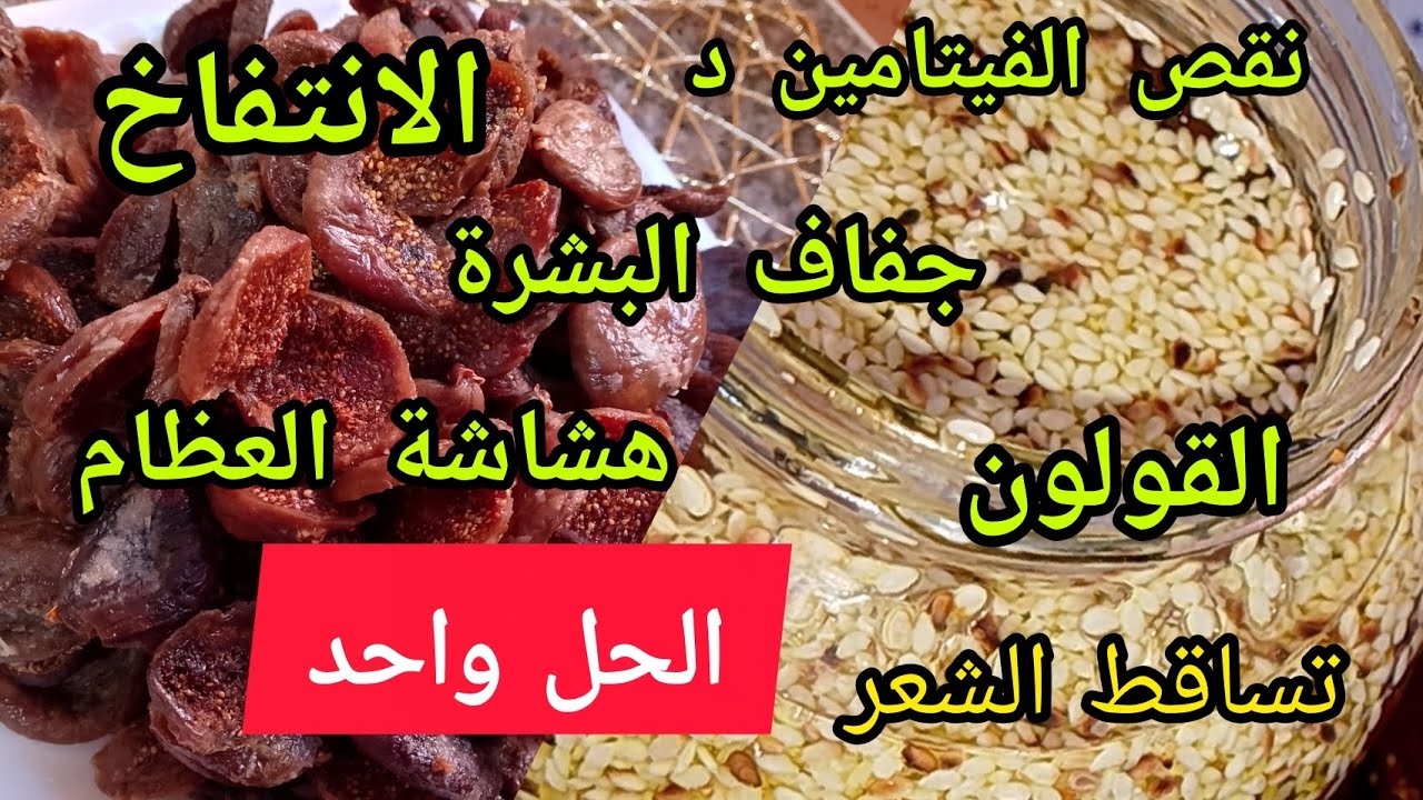 الانتفاخ والقولون ونقص الفيتامين د الحل النهائي هنا🔥👌💯