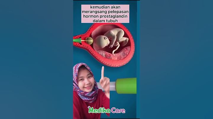 Induksi Dengan Kateter Foley