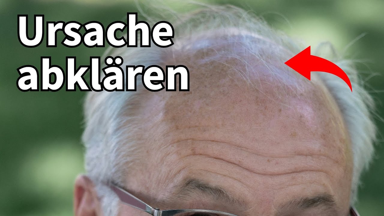 So klärst Du die Ursache bei Haarausfall ab