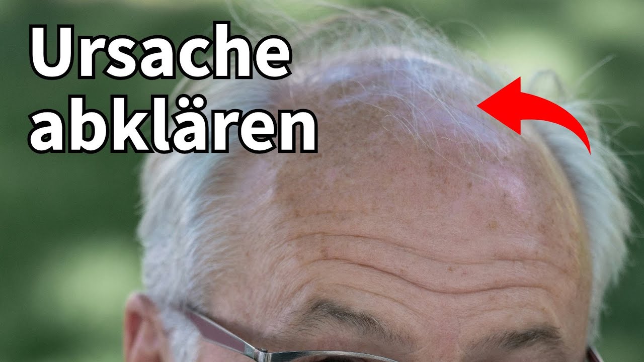 Was ist die Ursache von Haarausfall? So findest du heraus, ob eine Stressursache vorliegt.