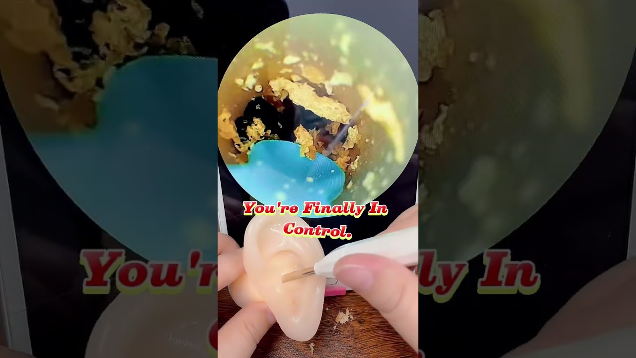 Satisfying Earwax Removal Videos for Relaxation 