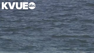 Teen hospitalized in Galveston after shark bite