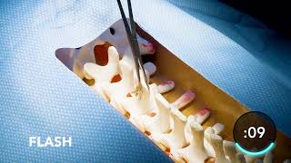 Information Surgical Registration Demo | 7D FLASH Navigation System News