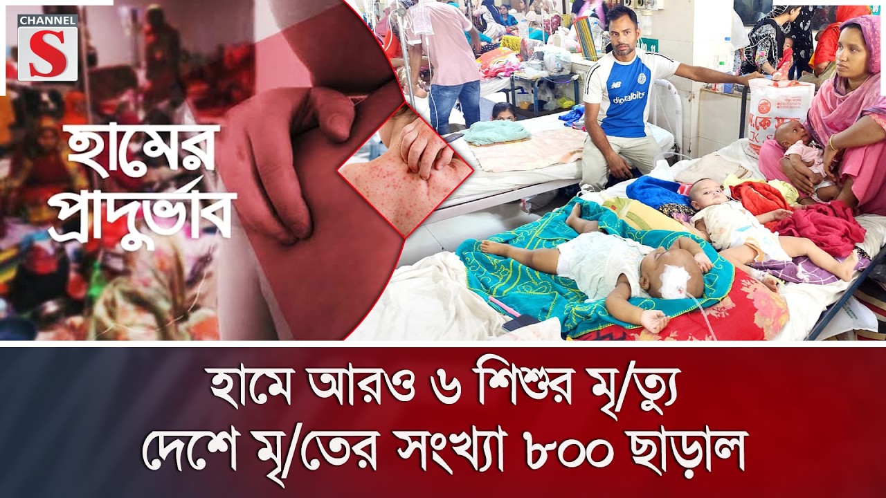 হামে আরও ৬ শিশুর মৃ/ত্যু; দেশে মৃ/তের সংখ্যা ৮০০ ছাড়াল | Measles | Health | Channel S News