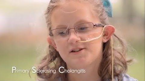 Faces of Primary Sclerosing Cholangitis (PSC)