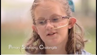 Faces of Primary Sclerosing Cholangitis (PSC)