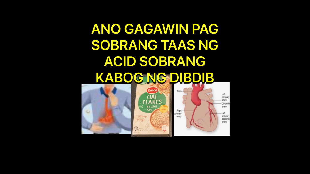 Try mo pag Sobrang Bilis ng Tibok ng Dibdib /Sobrang Acid / - YouTube