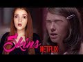 Skins Netflix