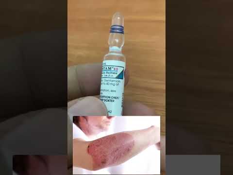 Video: Gentamicin kelas berapa?