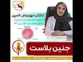 موضوع جنین بلاست چیست دکتر مهرنوش امیری