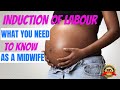 Induction of labourinductionbirthingdeliverymidwifery