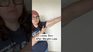 Embrace it! #bodypositivity #bodypositive #vsg #vsgsurgery #vsgcommunity #bariatricsurgery #plussize