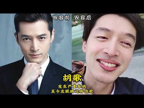 不幸「毀容」的明星今昔，邵音音黃夏蕙曾嚇跑小偷，胡歌令人惋惜