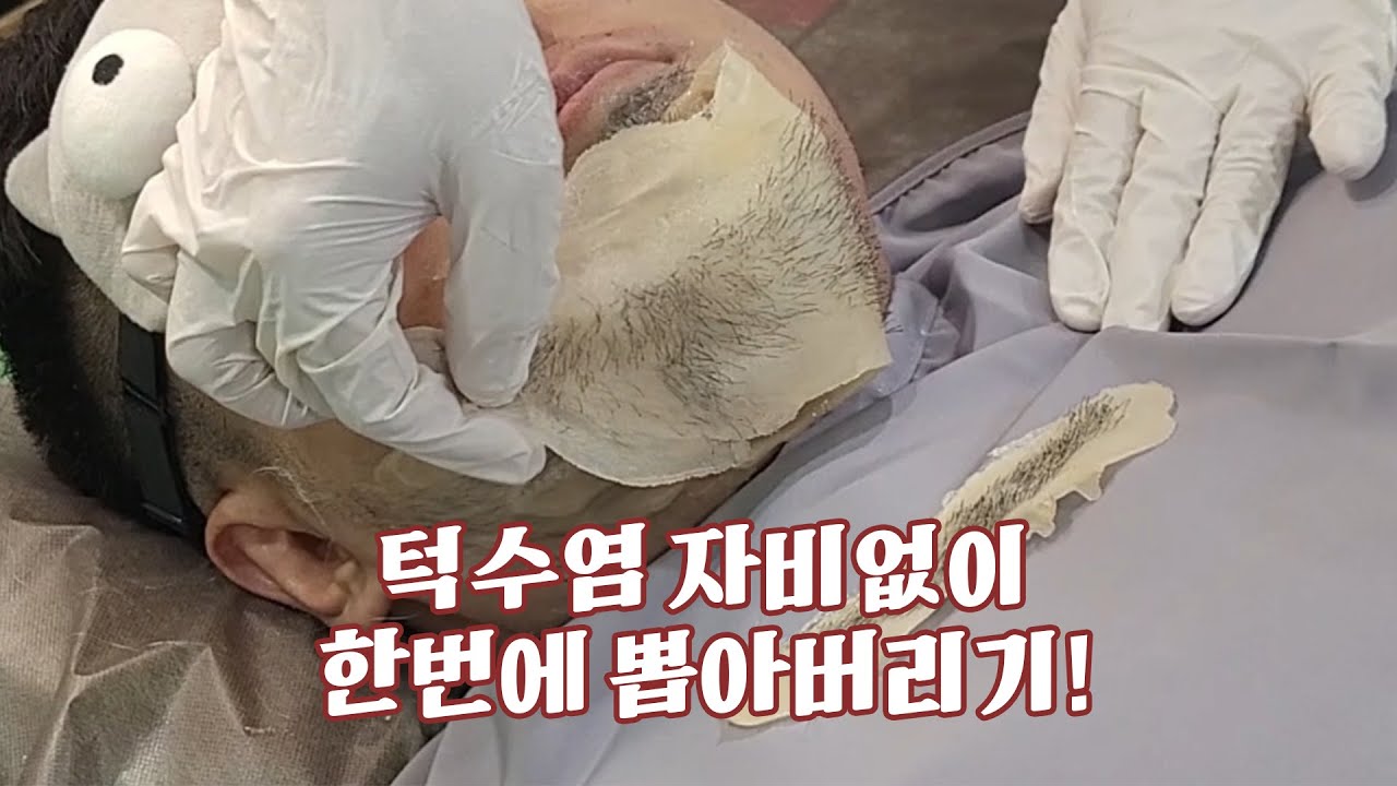 ASMR 수염왁싱 / 한번에 수염 뽑아버리기 / beard waxing / pull out the beard at once