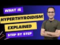 Hyperthyroidism graves disease symptoms diagnosis wolff chaikoff effect medicine lecture usmle