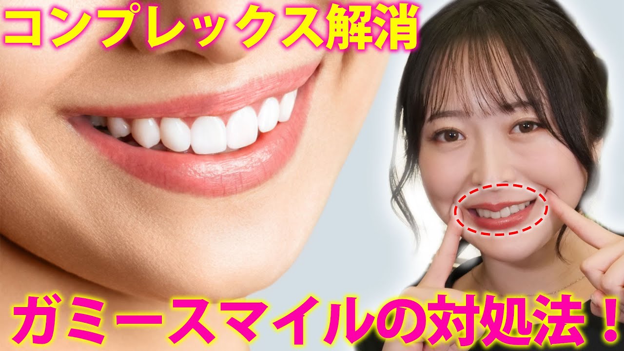 ガミースマイルの原因や対処法を解説！ - YouTube