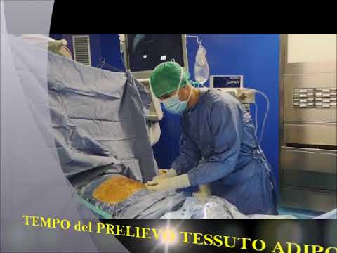 Video: Geni Di Riferimento Affidabili Per L'analisi Dell'espressione Di Cellule Stromali Adipose Umane Proliferanti E Differenzianti Adipogenicamente