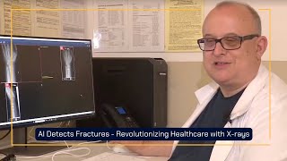 AI Detects Fractures - Revolutionizing Healthcare with X-rays