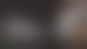 Orbit Tips 021 - Diabetic Retinopathy - Tractional retinal detachment