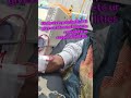 painful but gives u life ❤️ #ckdlife #kidney #dialysis #life #ytshorts #life