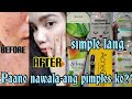 SKINCARE ROUTINE | PAANO NAWALA ANG TIGYAWAT KO |BABYGIRL YC