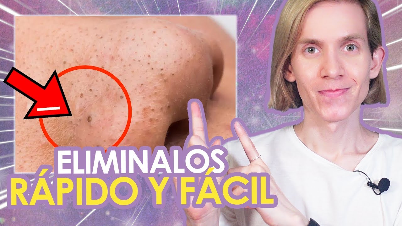 COMO ELIMINAR LOS PUNTOS NEGROS - Guia de productos y rutinas anti comedones - Simon Scarano