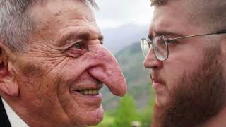 10 People With Impossible Body Parts (Photos Shock the World)