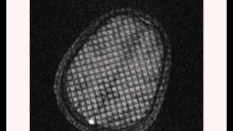 Quantitative Imaging Methods for the Development & Validation of Brain Biomechanics Models: Video 1