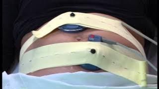 Fetal Monitoring During Labour