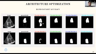 Segmentation of Heart Chambers in 2 D Heart Ultrasounds with Deep Learning