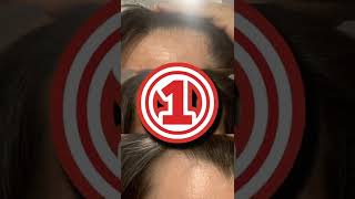 リアップ×５を1年間使ってみた結果　#shorts