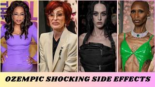 Famous 35 Ozempic Face Stars Before & After – #1 Will Shock You! Profile