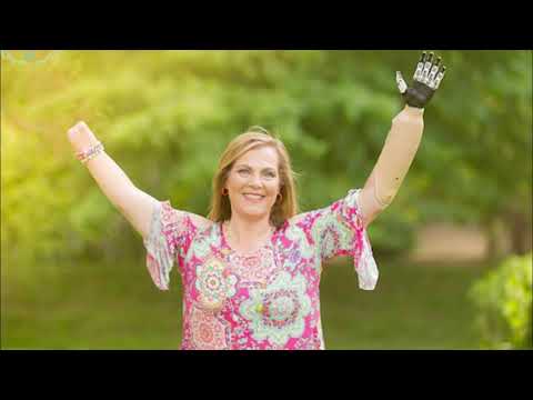 Kim's bebionic story