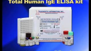 Total Human IgE ELISA kit