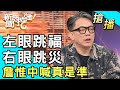 【搶播】左眼跳福右眼跳災？詹惟中喊真是準！