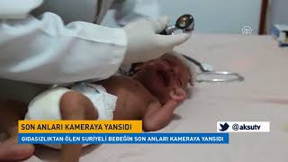 Gıdasızlıktan ölen Suriyeli bebeğin son anları kameraya yansıdı