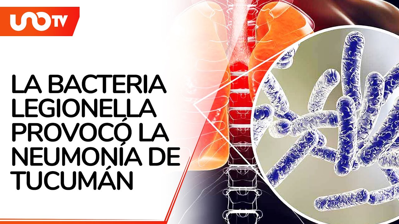 ¿Qué es la bacteria Legionella, la causante del brote de neumonía en