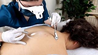 ASMR Dermatologist Pimples Extraction | Scalp Check, Back Exam, Sensory Tests on @DaisyJASMR