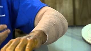 Surfer talks about being bitten by shark in Jensen Beach