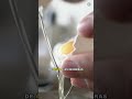 Por que a clara do ovo fica branca ao cozinhar? 🥚