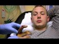 Bicycle Accident - Bizarre ER