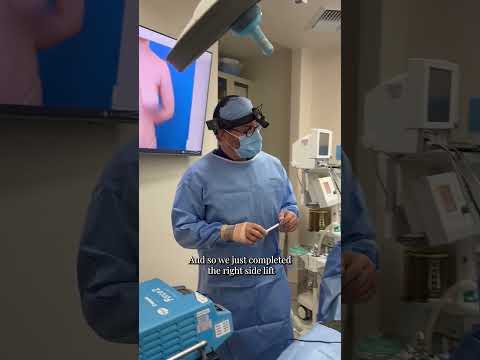 IN THE OR WITH DR. CHASAN - BREAST LIFT