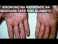 KISONONO NA KASWENDE NA MADHARA YAKE KWA MJAMZITO KISONONO NA KASWENDE NA MADHARA YAKE KWA MJAMZITO