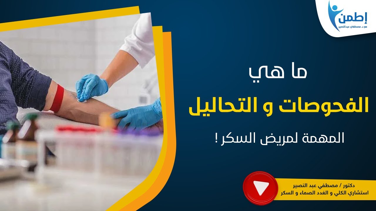 ما هي الفحوصات و التحاليل المهمة لمريض السكر !